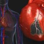 Reasons behind the intense increase of heart diseases
