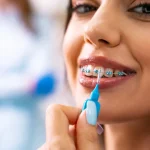 What To Eat And Avoid During Your Braces Treatment