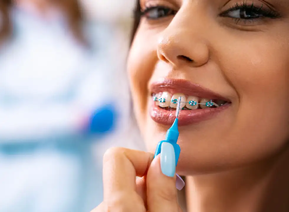 What To Eat And Avoid During Your Braces Treatment